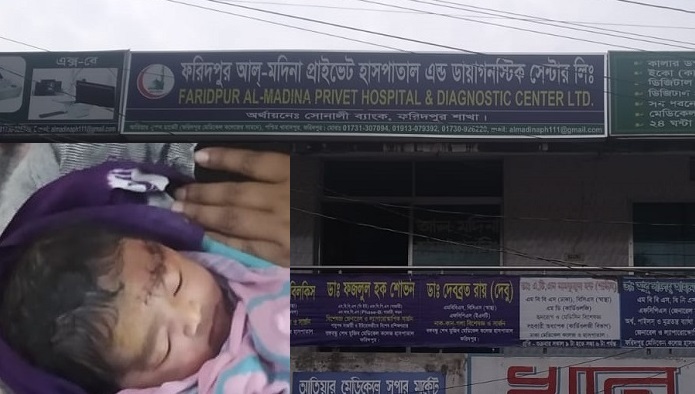 নার্স দ্বারা প্রসূতির ডেলিভারি, কাটল নবজাতকের কপাল