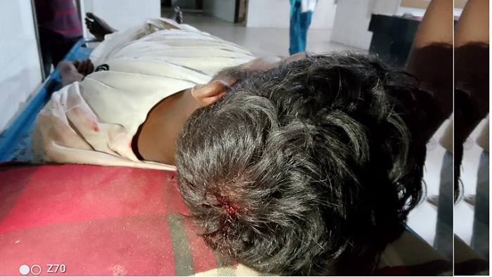 সালথায় কৃষককে হাতুড়ি দিয়ে পিটাল দুর্বৃত্তরা সালথায় কৃষককে হাতুড়ি দিয়ে পিটাল দুর্বৃত্তরা