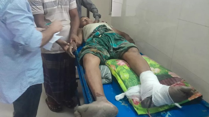 সালথায় কৃষকের পায়ের রগ কেটে দিলো প্রতিপক্ষ সালথায় কৃষকের পায়ের রগ কেটে দিলো প্রতিপক্ষ